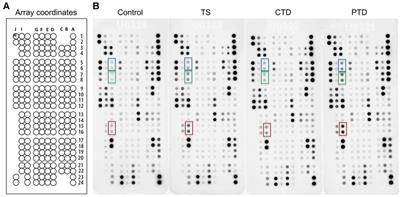 Association of elevated plasma CCL5 levels with high risk for tic disorders in children